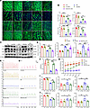 BMSC-MVs restore ENS structure and gastrointestinal motility in diabetic mi