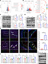 ER stress and UPR were activated in ENPCs under diabetic conditions.