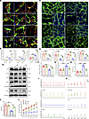 Inhibition of ER stress ameliorates diabetes-induced ENS injury by restorin