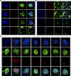 Uptake of BMSC-MVs by ENPCs and distribution within the ENS.