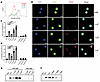 Pathogenic C. albicans infection–promoted autoantibody production was media