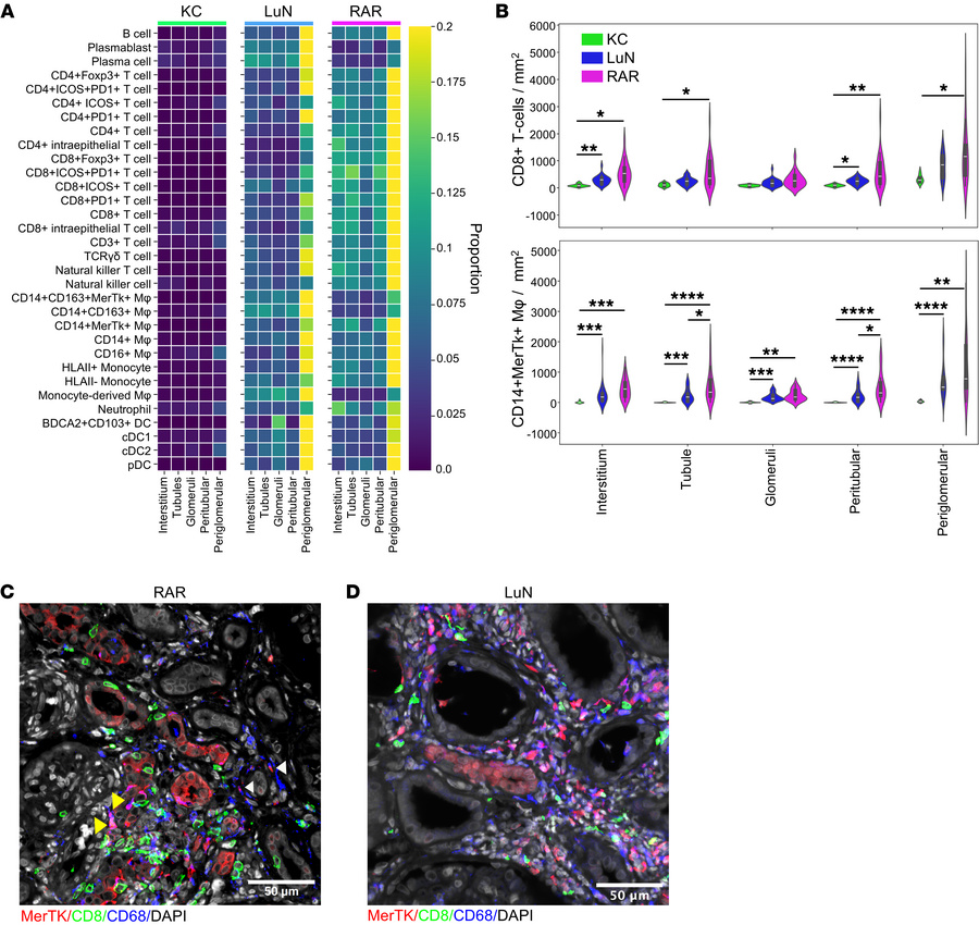 Distribution of inflammation across renal compartments.
(A) Heatmap show...