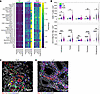 Distribution of inflammation across renal compartments.