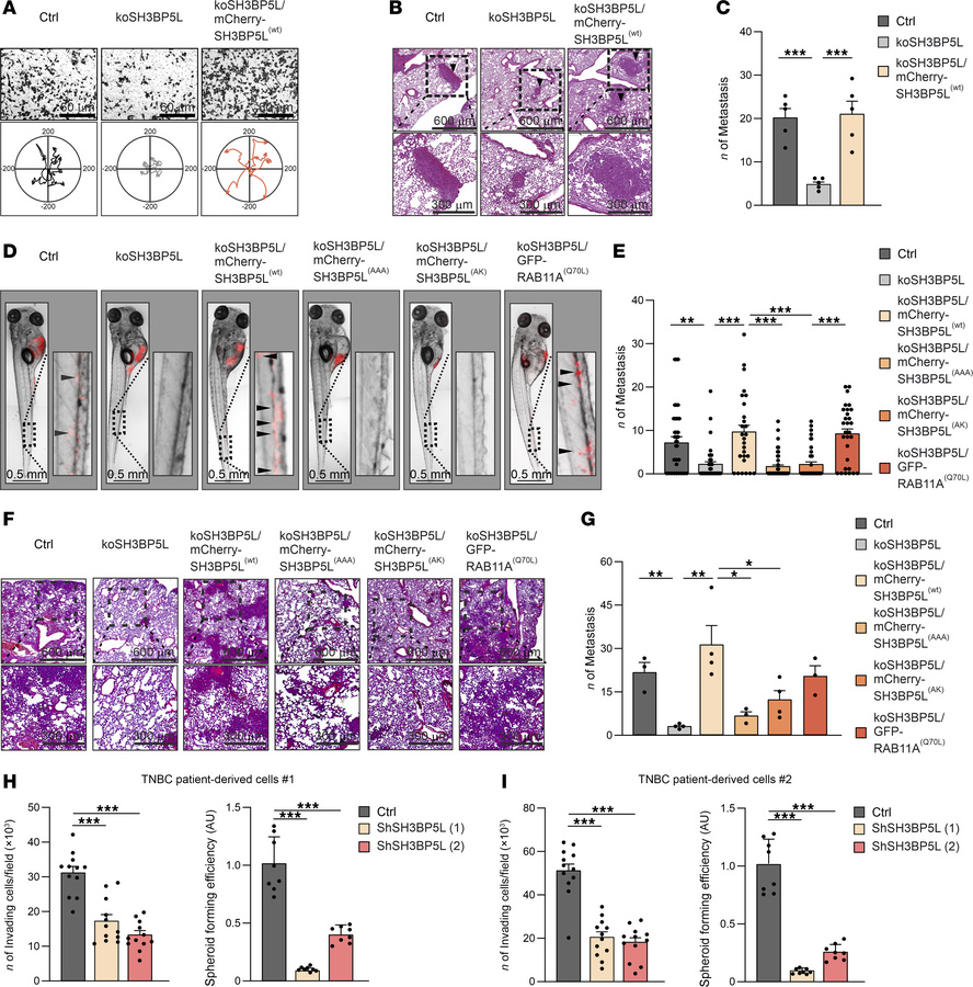 SH3BP5L enhances RAB11A-mediated invasion and metastasis.
(A) Representa...