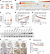 SH3BP5L expression in BC and association with patient outcomes.