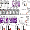 SH3BP5L enhances RAB11A-mediated invasion and metastasis.