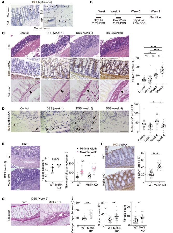 Meflin deficiency aggravates intestinal fibrosis in the DSS-induced coli...