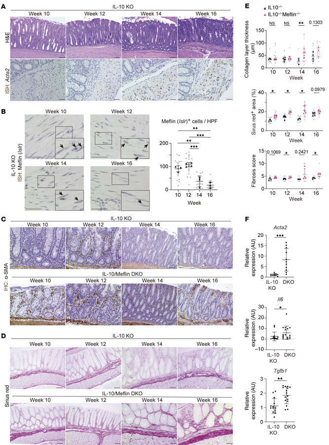 Meflin deficiency accelerates intestinal fibrosis in the IL-10–KO sponta...