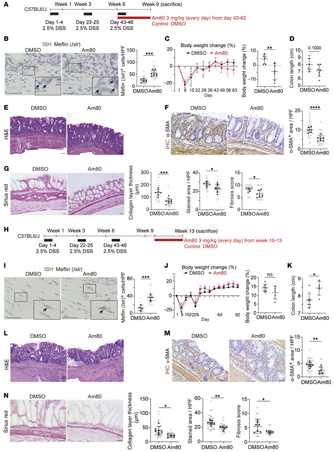 Antifibrotic effect of Am80 administration on intestinal fibrosis in the...