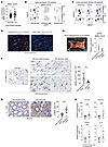 Downregulation of Meflin expression in fibroblasts in the intestinal strict