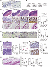 Meflin deficiency aggravates intestinal fibrosis in the DSS-induced colitis