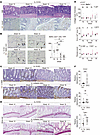 Meflin deficiency accelerates intestinal fibrosis in the IL-10–KO spontaneo