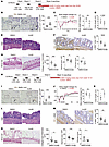 Antifibrotic effect of Am80 administration on intestinal fibrosis in the DS