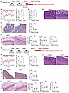 Am80-induced reversion of established intestinal fibrosis is mediated by Me