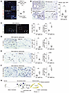 Dysregulated Wnt signaling in Meflin-deficient mice.