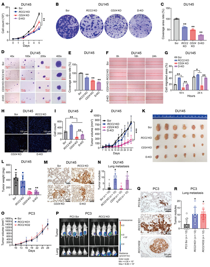 Effects of CD24 and RCC2 knockouts on cell proliferation, migration, tum...