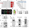 Interaction between RCC2 and Vimentin and the role of RCC2 in Vimentin degr