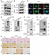 Regulation of RCC2 by CD24 and its impact on β-catenin signaling in prostat
