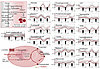 Effect of short-stored versus long-stored blood on glycolysis, the PPP, and
