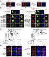Cytoplasmic sequestration of RUNX1 by CBFβ-SMMHC is dispensable for leukemi