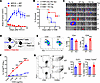 PIM2 negatively regulates T cell antitumor responses.