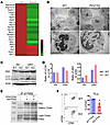 PIM2 negatively regulates autophagic flux in CD8 T cells.
