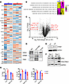 PIM2 negatively regulates VPRBP/EZH2 activity.
