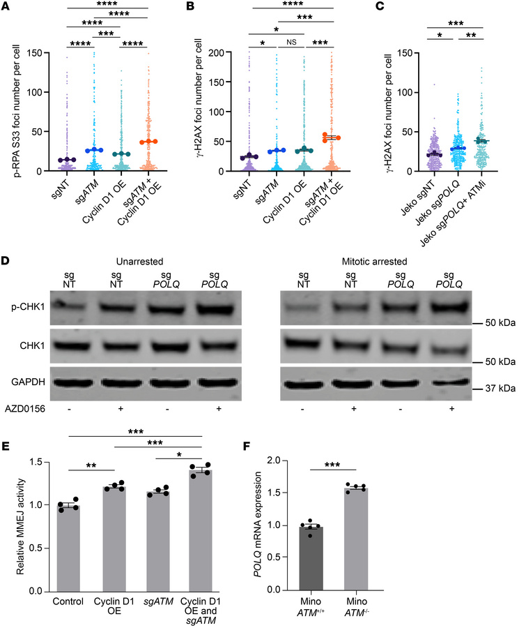 Concurrent deficiency in ATM with cyclin D1 overexpression augments RS, ...