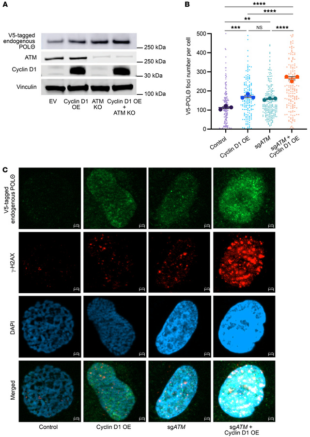 POLΘ protein expression is further increased by ATM deficiency in cyclin...