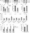 Cyclin D1 overexpression specifically increases the expression of POLQ thro