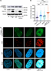 POLΘ protein expression is further increased by ATM deficiency in cyclin D1