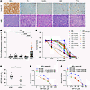 POLQ is overexpressed in MCL compared with other NHLs, and its inhibition s