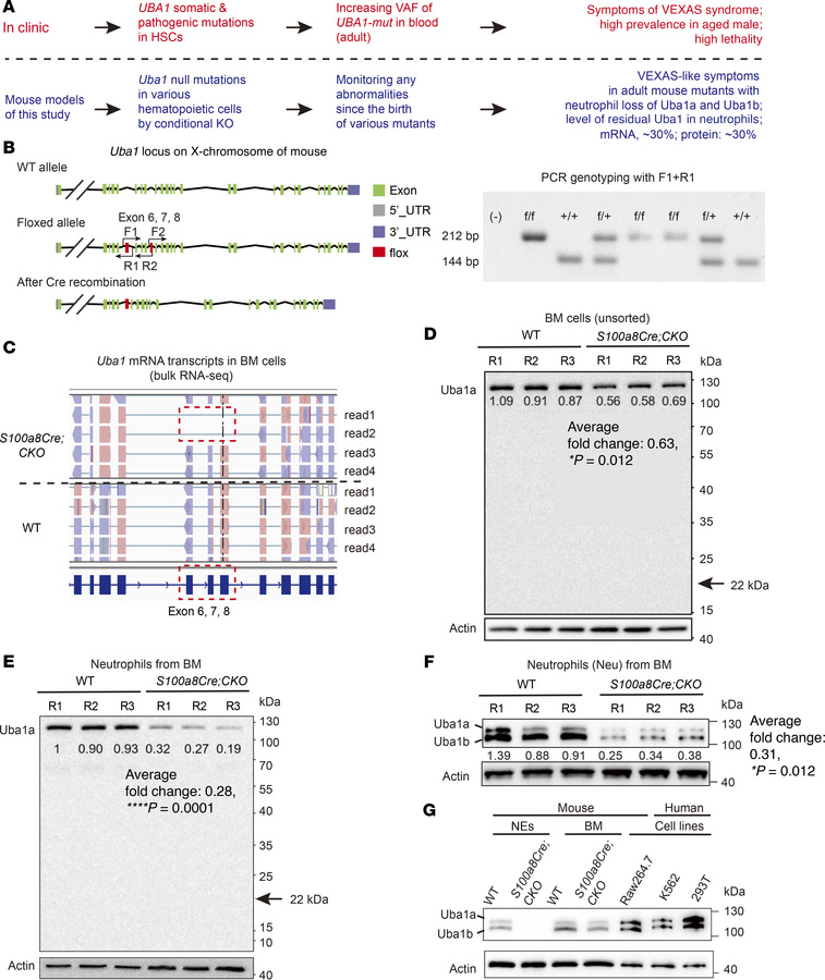 Conditional depletion of Uba1 in mice.
(A) A brief introduction of VEXAS...