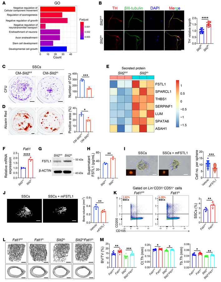 FSTL1 secreted from sympathetic nerves inhibits SSC self-renewal and ost...