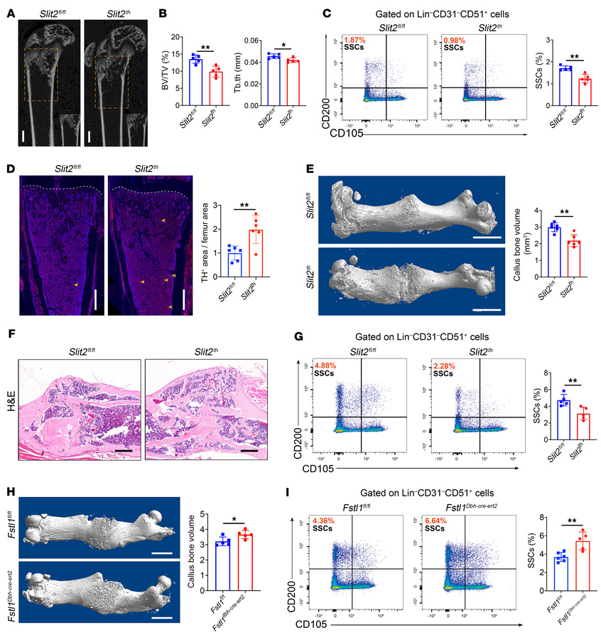 Sympathetic hyperinnervation disrupts bone regeneration by impairing SSC...