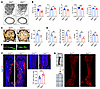Bone loss, impaired bone formation, and sympathetic hyperinnervation in Sli