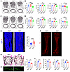 Slit2th but not Slit2adv mice recapitulate the skeletal and nerve phenotype