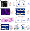 Sympathetic hyperinnervation disrupts bone regeneration by impairing SSC ex