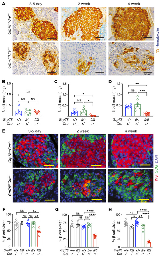 β cell GRP78 deletion reduced β cell mass and disrupted islet architectu...