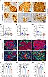 β cell GRP78 deletion reduced β cell mass and disrupted islet architecture.