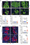 Loss of β cell mass after GRP78 deletion was predominantly due to increased