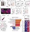 Ex vivo GRP78 depletion increased β cell death and transcriptional signatur