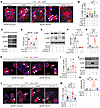 IRE1-dependent JNK activation, but not CHOP induction, leads to β cell deat
