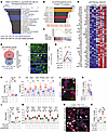 JNK inhibition or acute p53 inhibition both rescue β cell death.