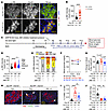 JNK inhibition reduces β cell death in Grp78-deletion mice.