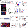 JNK inhibition decreases β cell death in Akita mice.