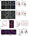 Inhibition of either JNK or p53 reduces human β cell death after GRP78 depl