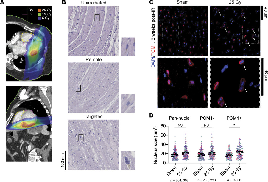 Cardiac radiation alters cardiomyocyte nucleus size.
(A) Thoracic CT sca...