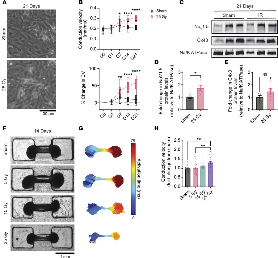 IR induces cardiomyocyte-autonomous CV increases in a dose-dependent fas...