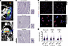 Cardiac radiation alters cardiomyocyte nucleus size.